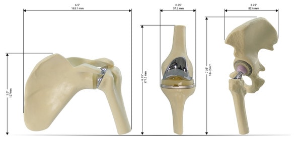 Mini Implant Joint Anatomy Model Set Item Dimensions Mini Implant Joint Anatomy Model Set Item Dimensions