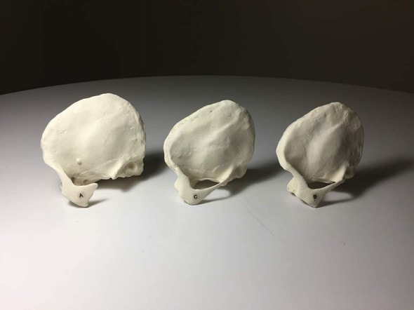 Temporal Bone Phantoms for X-Ray CT, Ultrasound, MRI