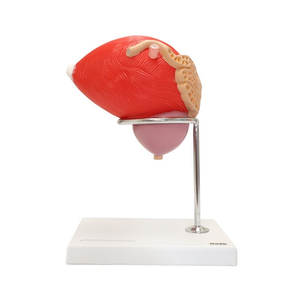 Axis Scientific Male Urinary Bladder with Prostate Numbered Anatomy Model, 2 Parts