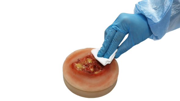 Decubitus Stage 3 Ulcer Care Task Trainer