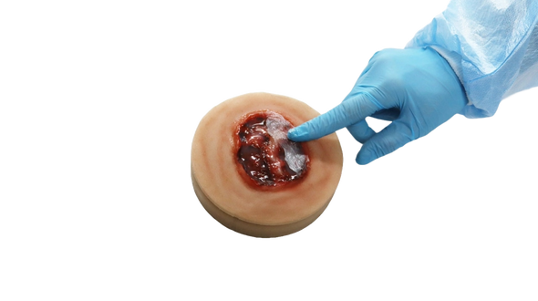 Decubitus Stage 4 Ulcer Care Task Trainer