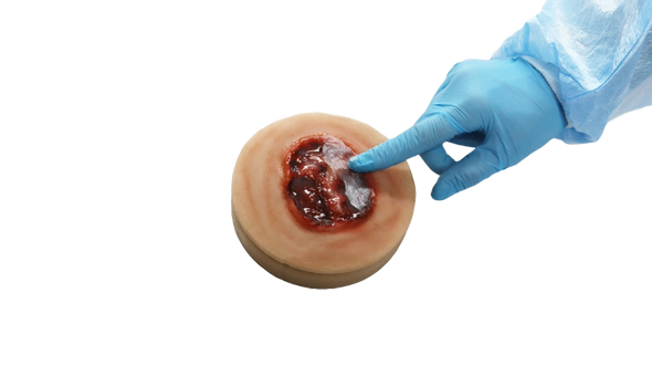 Decubitus Stage 4 Ulcer Care Task Trainer