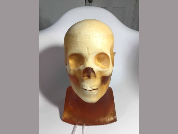 Adult Head (Hematoma) for X-Ray CT, US, MRI