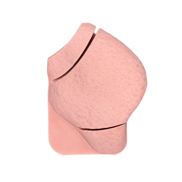 Replacement Lung