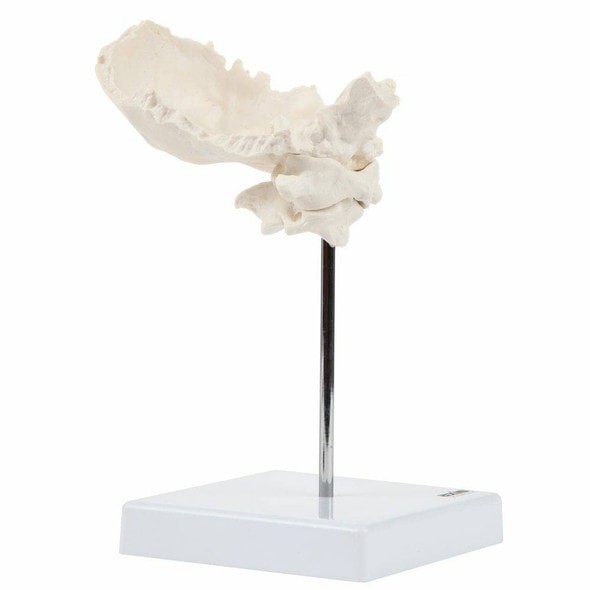 Axis Scientific Occipital Bone - C1 and C2 Axis Scientific Occipital Bone - C1 and C2