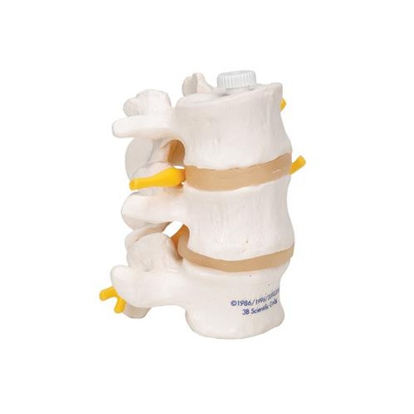 Lumbar Vertebrae Anatomy Model - Right Side View Lumbar Vertebrae Anatomy Model - Right Side View