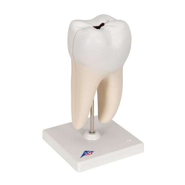 Lower Twin-Root Molar Anatomy Model 2 Parts