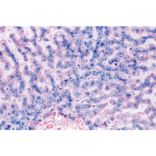 Human Pathology - English Microscope Slides Basic Set Human Pathology - English Microscope Slides Basic Set