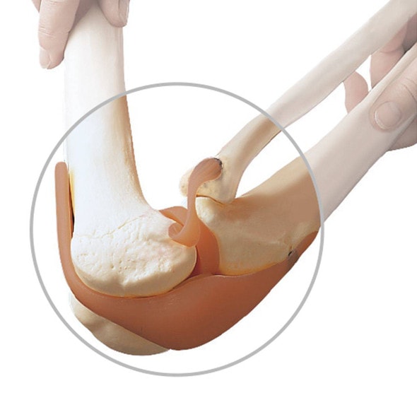 Replacement Knee Ligament for 3B Scientific Skeletons Replacement Knee Ligament for 3B Scientific Skeletons