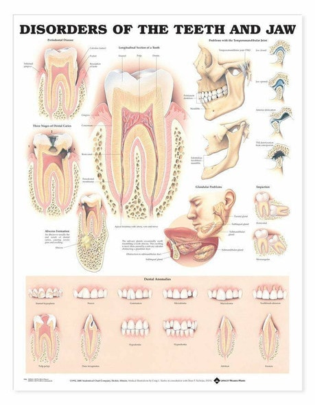 Disorders Of The Teeth and Jaw Laminated Anatomical Chart Disorders Of The Teeth and Jaw Laminated Anatomical Chart