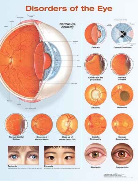 Disorders Of The Eye Laminated Anatomical Chart - 3rd Edition