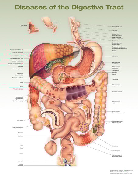 Diseases of the Digestive System Laminated Anatomical Chart