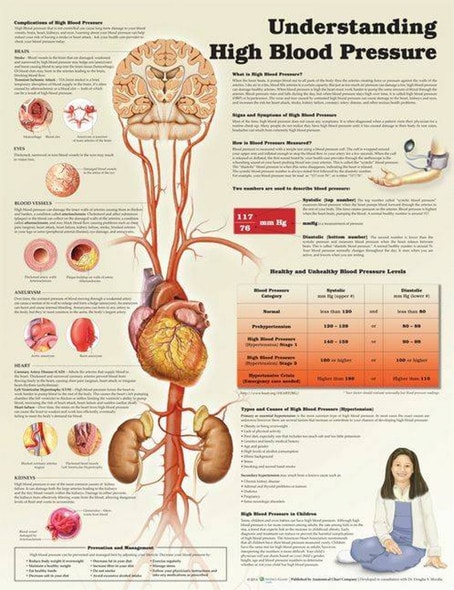 Understanding High Blood Pressure Laminated Anatomical Chart - 2nd Edition