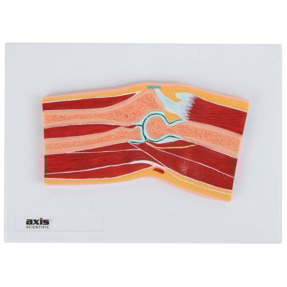 Axis Scientific Elbow Joint Section Anatomy Model Axis Scientific Elbow Joint Section Anatomy Model