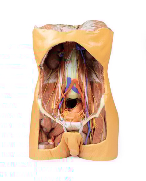 3D Printed Posterior Abdominal wall 3D Printed Posterior Abdominal wall