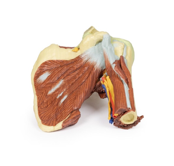 3D Printed Shoulder - Deep Dissection of the Left Shoulder Joint 3D Printed Shoulder - Deep Dissection of the Left Shoulder Joint