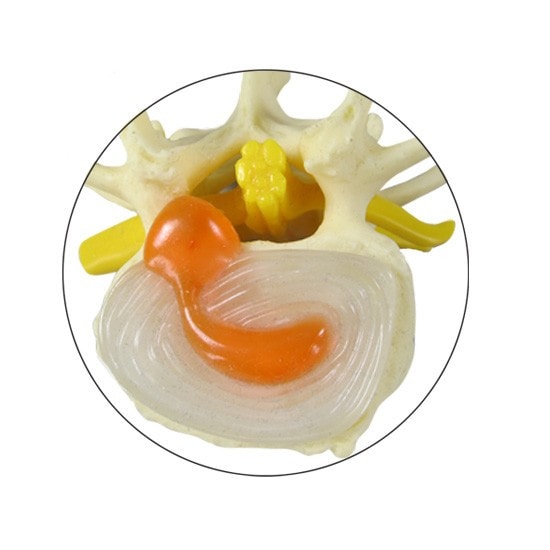 Four Stage Vertebrae Set Anatomy Model