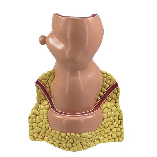 Rectum Anatomy Model With Pathologies