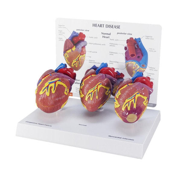 3 Piece Mini Heart Anatomy Models Set