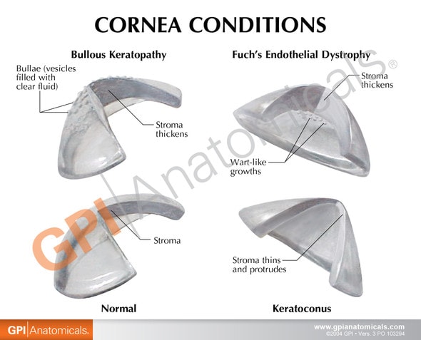 Cornea Cross Section Eye Anatomy Model