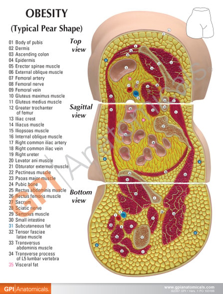 Obesity Anatomy Model