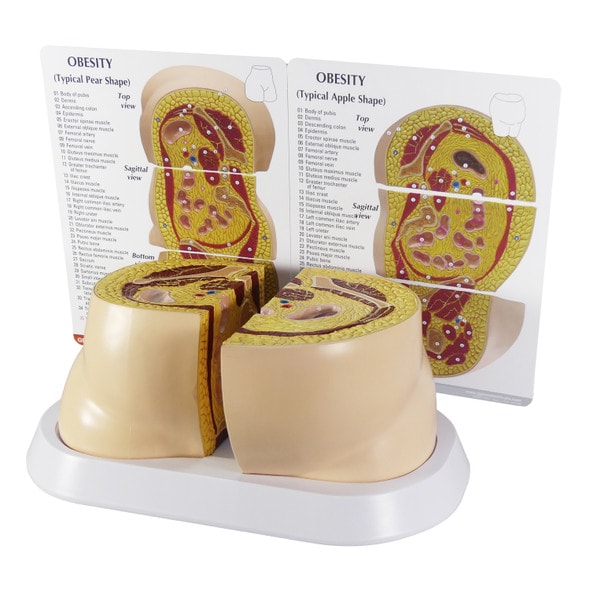 Obesity Anatomy Model