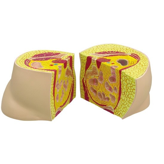 Obesity Anatomy Model