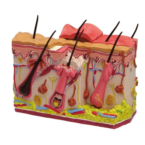 Skin Burn and Normal Skin Anatomy Model
