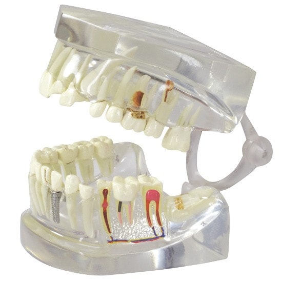 Clear Human Jaw with Teeth Anatomy Model