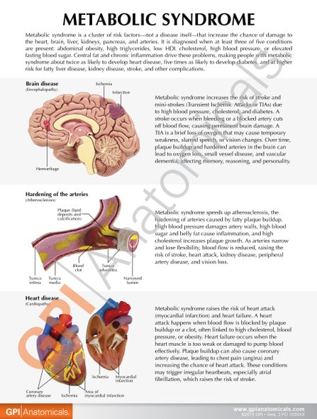 Metabolic Syndrome Anatomy Model Set - front