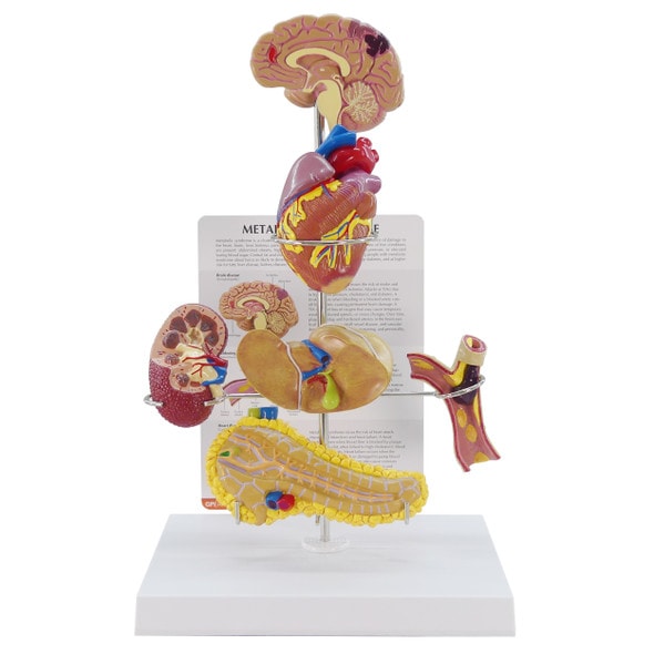 Metabolic Syndrome Anatomy Model Set