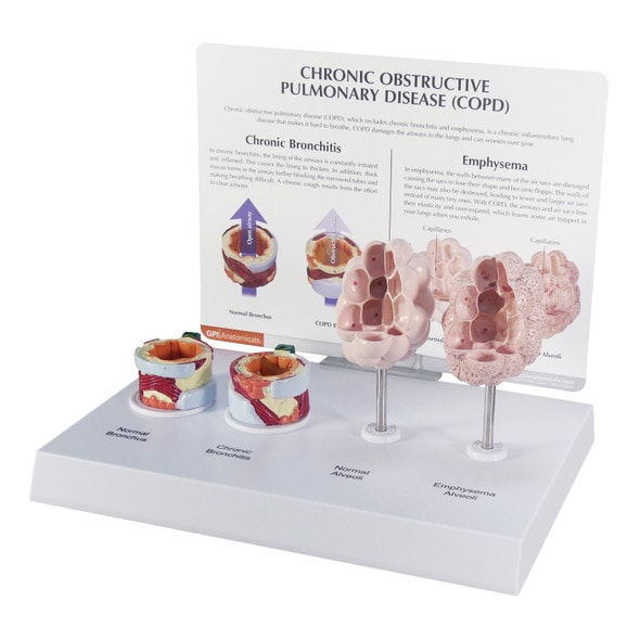 COPD Model with Bronchus and Alveoli