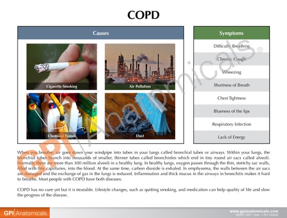 COPD Model with Bronchus and Alveoli