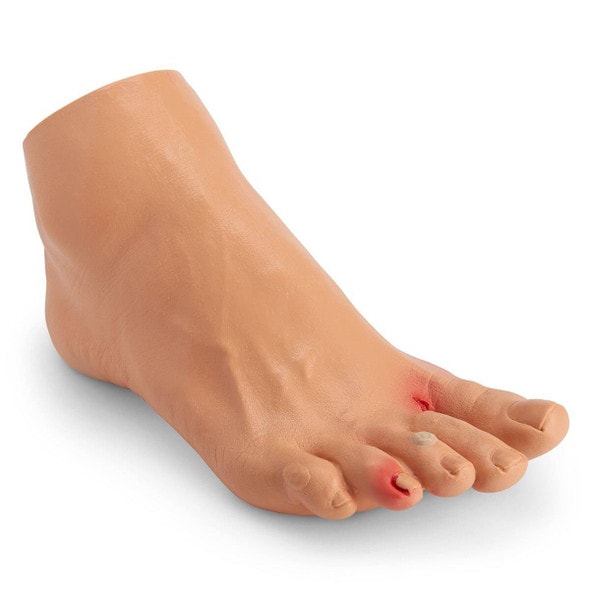 Nasco Healthcare Elderly Pressure Ulcer Foot - Light