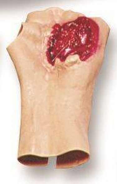 Gunshot Wound Of The Palm Model