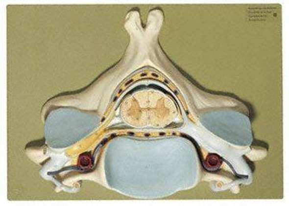 SOMSO Fifth Cervical Vertebra- 7x Life Size SOMSO Fifth Cervical Vertebra- 7x Life Size