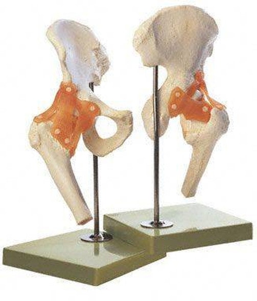 SOMSO Premium Functional Hip Joint Model
