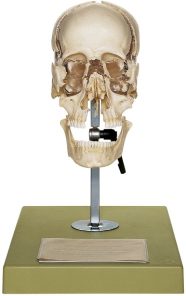 SOMSO Beauchene Adult Human Skull in 22 Parts