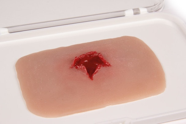 Skin Moulage, Bullet Hole Wound - Exit