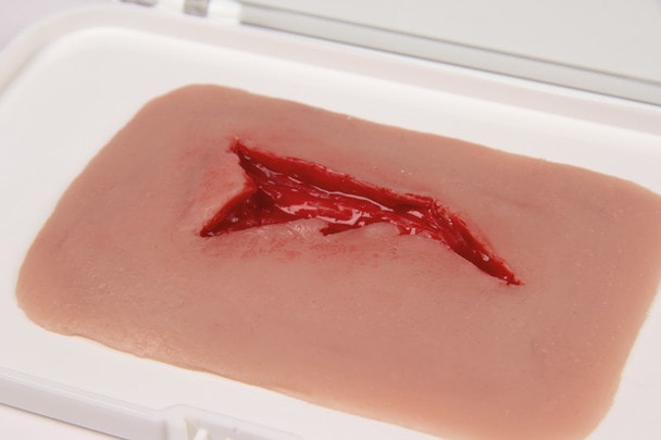 Skin Moulage, Laceration Wound