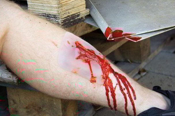 Skin Moulage, Laceration Wound