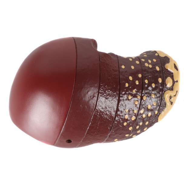 Axis Scientific Life-Size Human Liver with the Progression of Liver Disease