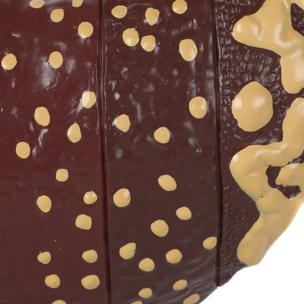 Axis Scientific Life-Size Human Liver with the Progression of Liver Disease