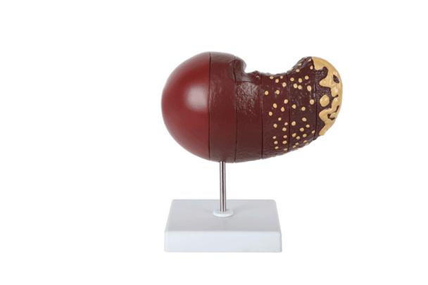 A liver model on a stand with internal structures visible.