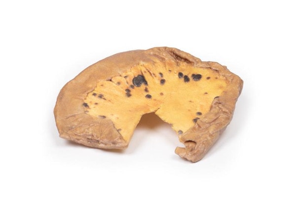 3D Printed Mesenteric Metastases from Cutaneous Malignant Melanoma
