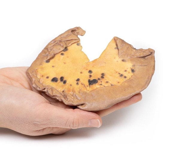 3D Printed Mesenteric Metastases from Cutaneous Malignant Melanoma