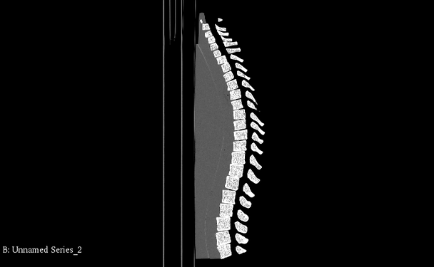 Adult Spine Phantom Model - CT scans
