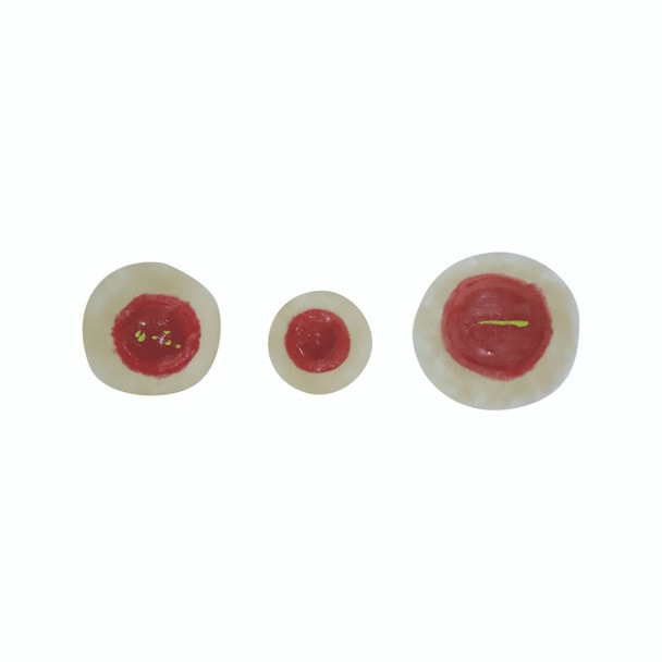 Anatomy Lab SP Moulage for TCM - Acute Mastitis module
