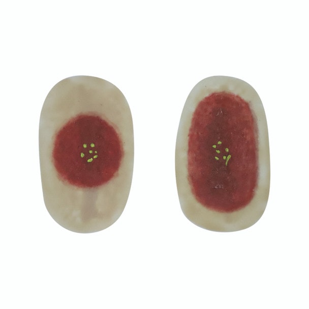 Anatomy Lab SP Moulage for TCM - Carbuncle module