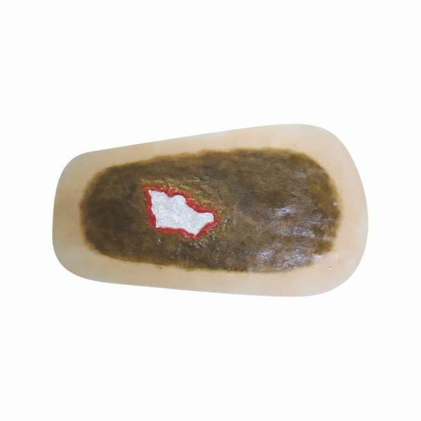 Anatomy Lab SP Moulage for TCM - Ecthyma module